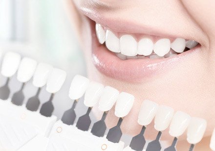 Zahnarztpraxis Katrin Lang - in Regensburg - Ästhetische Zahnmedizin - Bleaching